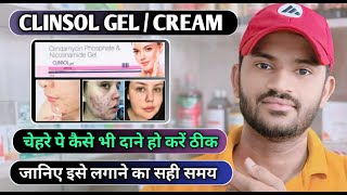 Clinsol gel how to use full review in hindi [upl. by Samanthia]