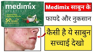 Medimix Soap Review In Hindi  medimix sabun ke fayde [upl. by Fatimah]