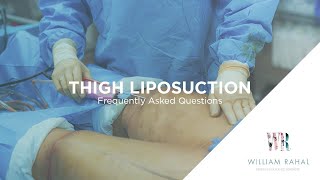 Thigh Liposuction Recovery amp other FAQs Frequently Asked Questions [upl. by Tarton607]