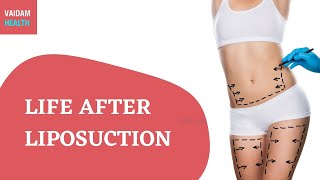 Life after Liposuction [upl. by Cobb]