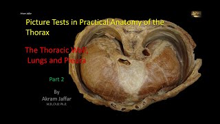 How to Interpret a Chest XRay Lesson 4  Airways Bones and Soft Tissues [upl. by Adnaval464]