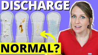 Doctor Answers Top 5 Discharge Questions [upl. by Ettezoj638]