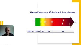 liver fibroscans explained [upl. by Aikemahs]