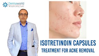 Isotretinoin capsules  Treatment for Acne removal  In Hindi  Dr Rohit Batra [upl. by Enniroc928]