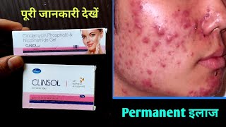 दोनों को इस्तेमाल करें Clinsol gel and Clinsol Soap Uses in Hindi [upl. by Erastus]