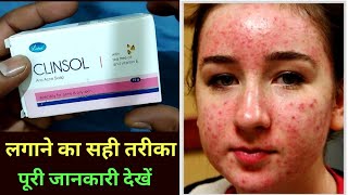 लगाते ही आराम Clinsol Soap Benefits and Side effects in hindi [upl. by Naoj693]