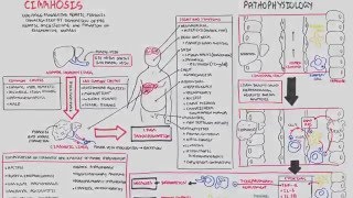 Liver Cirrhosis SandS Pathophysiology Investigations Management [upl. by Keily]