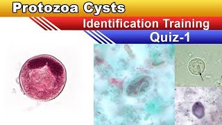 Protozoa Cysts Identification Training Quiz  Part 1 [upl. by Kasevich444]