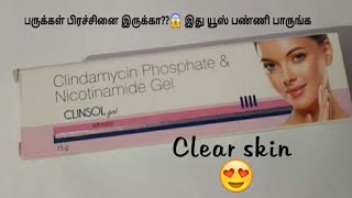 clinsol gel review in tamil [upl. by Zilla]