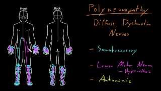 Syndrome Polyneuropathy [upl. by Eliezer]