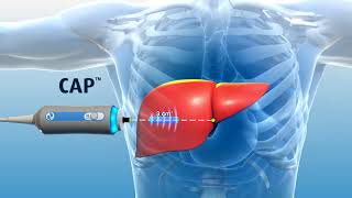 Liver Explained Function Pathology Diseases amp Cirrhosis [upl. by Rovert]