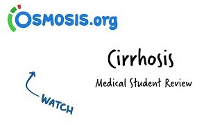 Cirrhosis Overview  Clinical Presentation [upl. by Conrad]