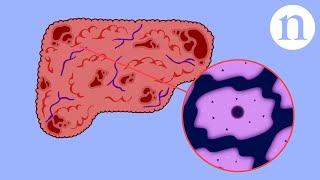 How to ultrasound the liver [upl. by Penman]