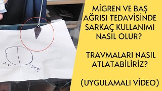 Migren ve Baş Ağrısı Tedavisinde Sarkaç Kullanımı Nasıl Olur  Travmaları Nasıl Atlatabiliriz [upl. by Sukcirdor577]