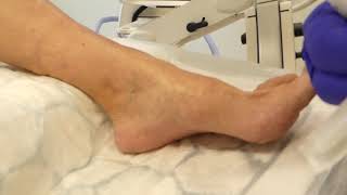 Gout  Symptoms causes diagnoses treatment [upl. by Jez]