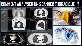 principe de la radiographie [upl. by Blakeley]