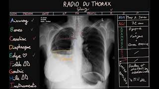 Articulations du thorax Partie 1 [upl. by Cecile]