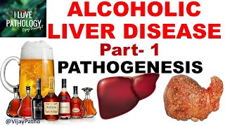 ALCOHOLIC LIVER DISEASE Part 1 Pathogenesis [upl. by Ogir529]