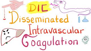 Disseminated Intravascular Coagulation DIC [upl. by Kcirddor]